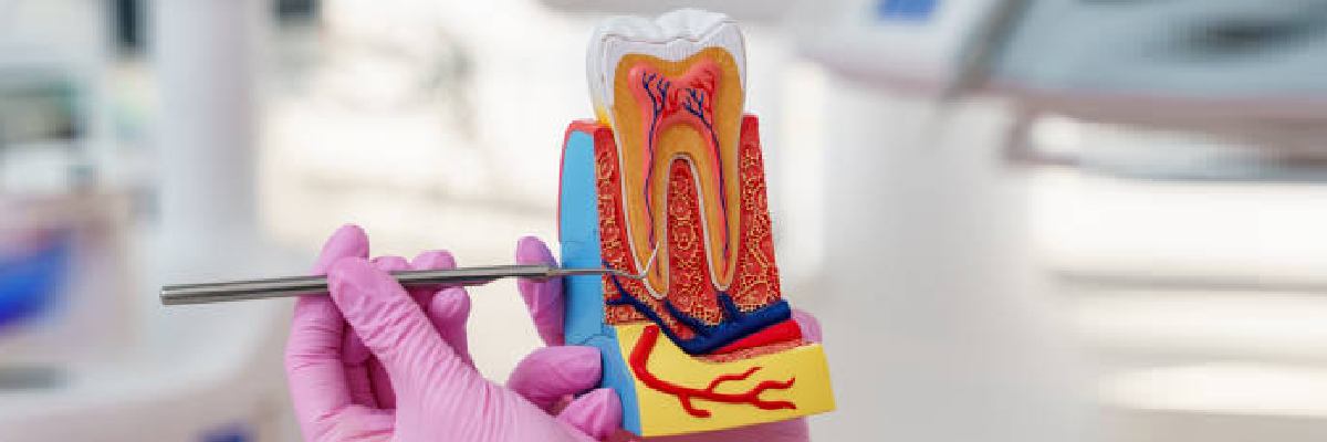 endodoncia