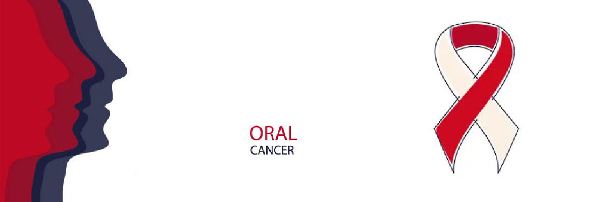 cáncer oral