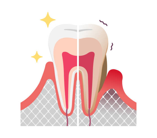 periodoncia