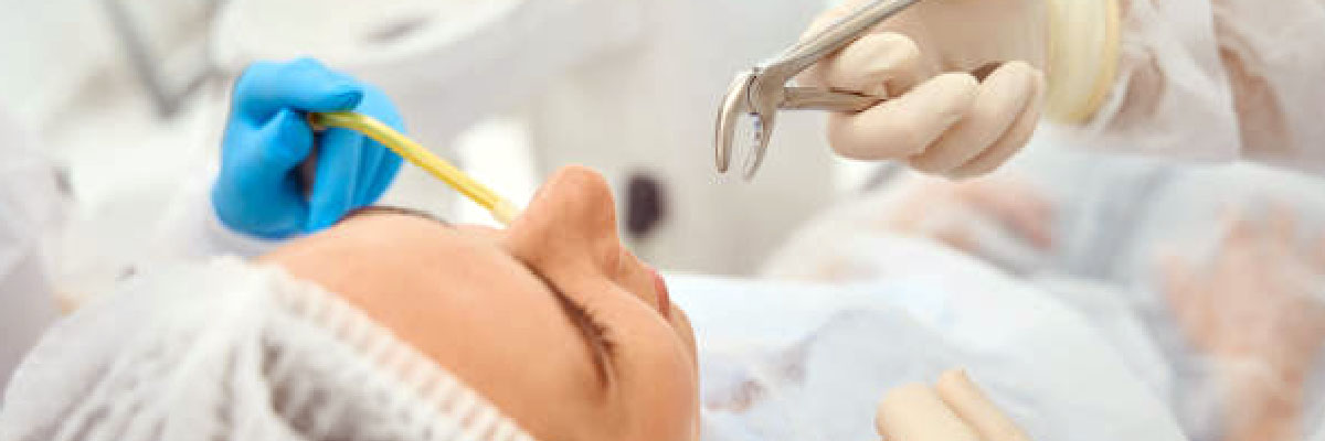 Extracción dental